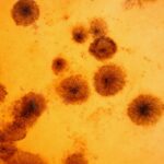 Toksoplasma Itu Apa? Memahami Arti, Bahaya, dan Cara Mencegahnya