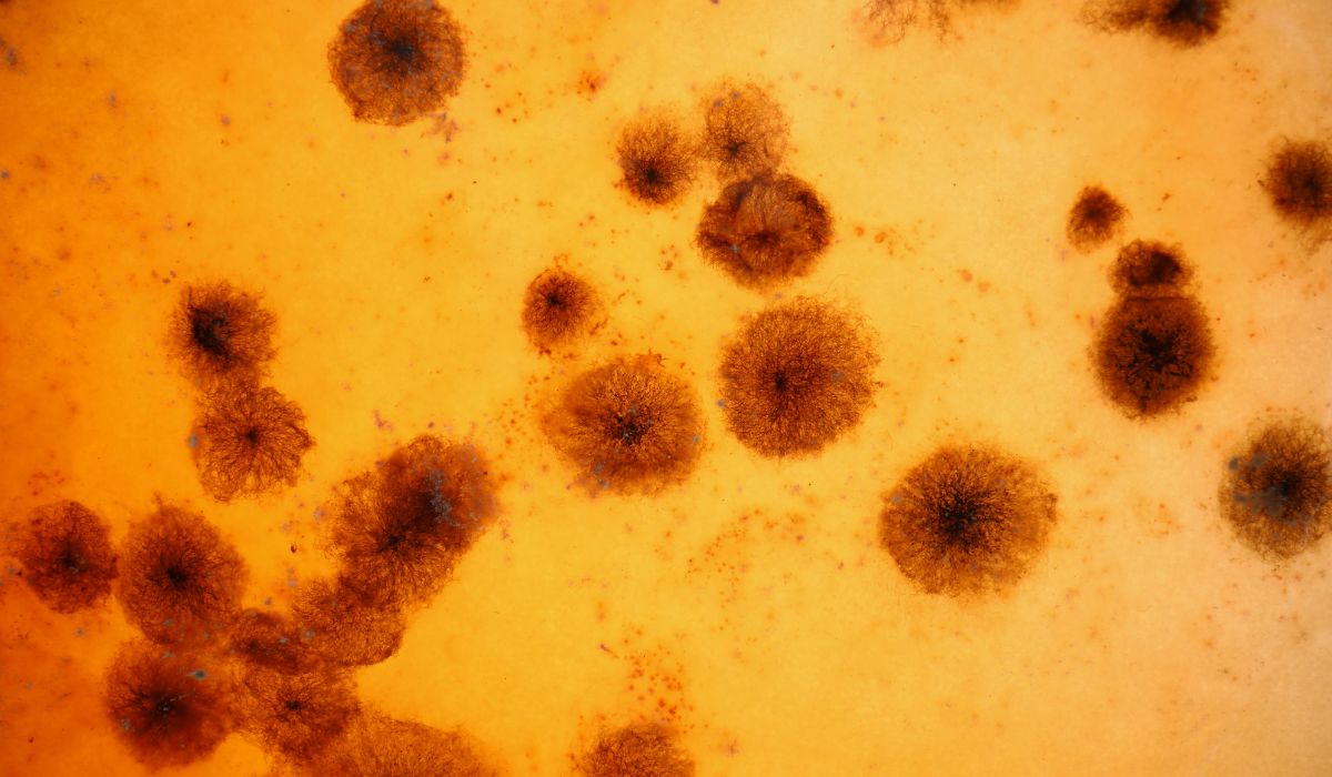 Toksoplasma Itu Apa? Memahami Arti, Bahaya, dan Cara Mencegahnya