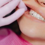 Cara Memutihkan Gigi yang Aman dan Efektif