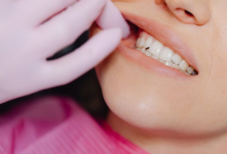 Cara Memutihkan Gigi yang Aman dan Efektif