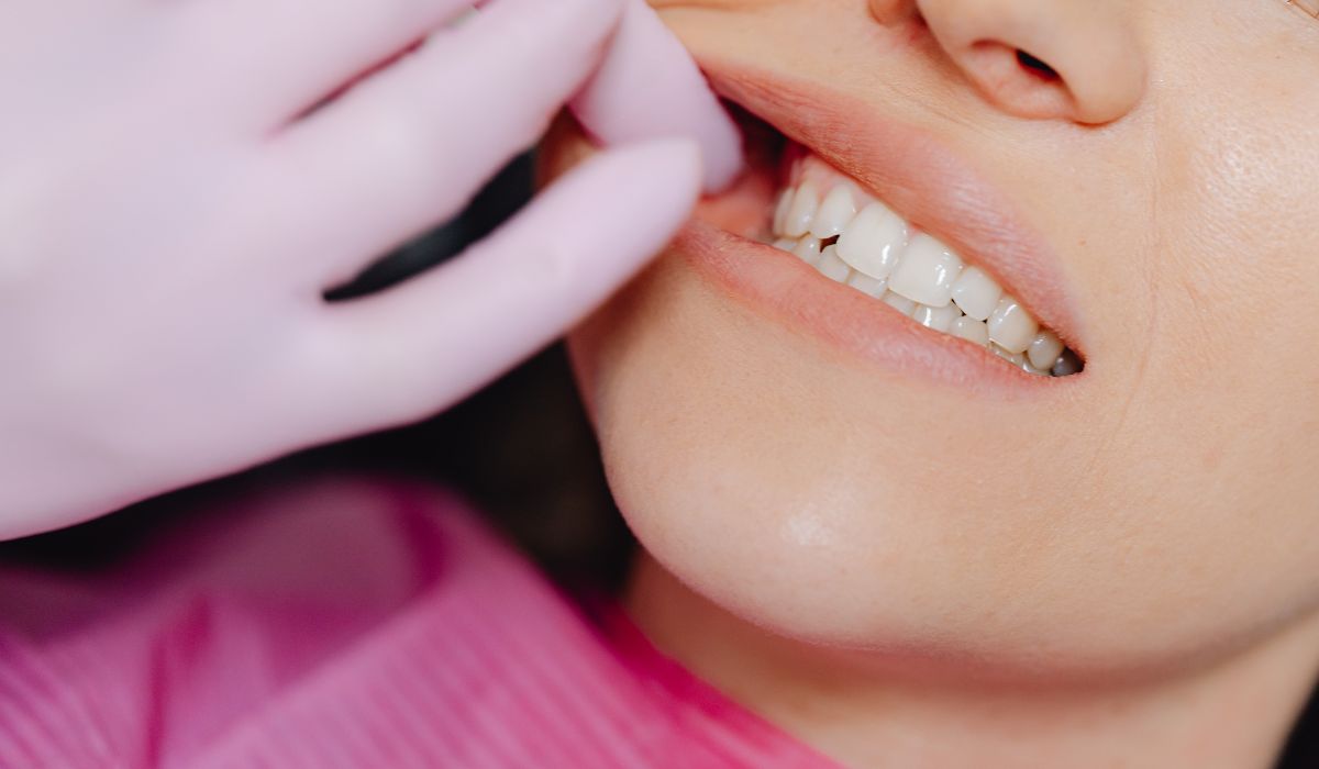 Cara Memutihkan Gigi yang Aman dan Efektif