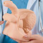 Apakah Varikokel Bisa Sembuh Sendiri? Fakta dan Solusi yang Harus Anda Tahu