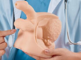 Apakah Varikokel Bisa Sembuh Sendiri? Fakta dan Solusi yang Harus Anda Tahu