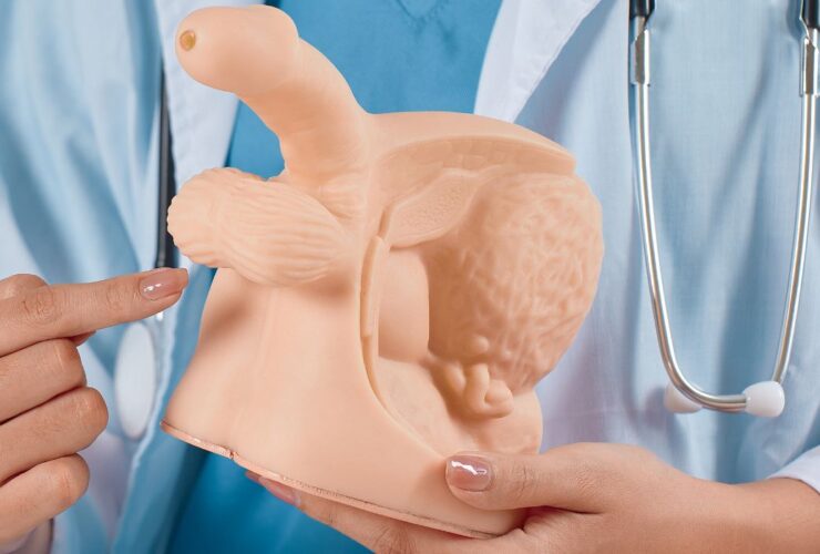 Apakah Varikokel Bisa Sembuh Sendiri? Fakta dan Solusi yang Harus Anda Tahu