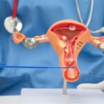 Fase Folikuler Adalah: Menguak Awal Siklus Menstruasi yang Penuh Potensi