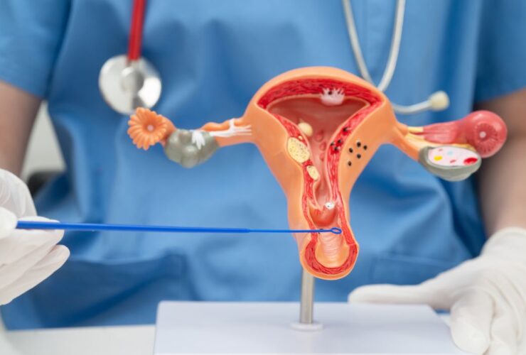 Fase Folikuler Adalah: Menguak Awal Siklus Menstruasi yang Penuh Potensi