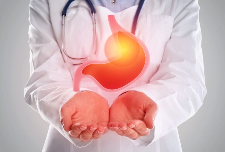 Puasa untuk Penderita GERD: Aman dan Nyaman Tanpa Takut Kambuh