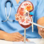 15 Gejala Sakit Ginjal yang Sering Tidak Disadari, Jangan Anggap Remeh!