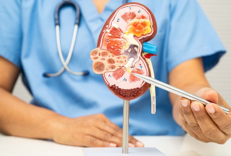 15 Gejala Sakit Ginjal yang Sering Tidak Disadari, Jangan Anggap Remeh!