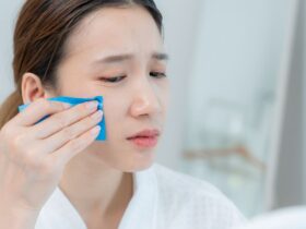 Mengatasi Wajah Berminyak: Penyebab hingga Solusi