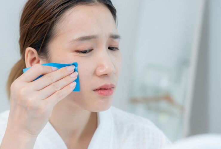 Mengatasi Wajah Berminyak: Penyebab hingga Solusi